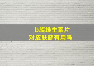 b族维生素片对皮肤藓有用吗