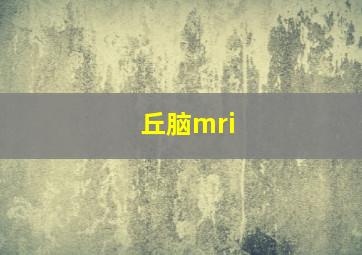 丘脑mri