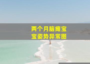 两个月脑瘫宝宝姿势异常图