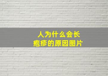 人为什么会长疱疹的原因图片