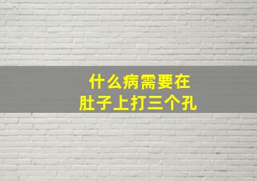 什么病需要在肚子上打三个孔