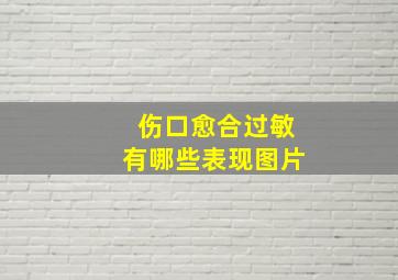 伤口愈合过敏有哪些表现图片