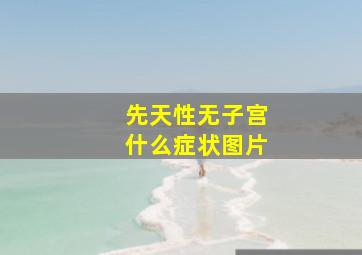 先天性无子宫什么症状图片