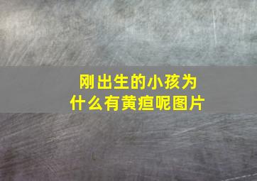 刚出生的小孩为什么有黄疸呢图片