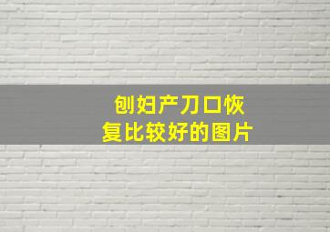 刨妇产刀口恢复比较好的图片