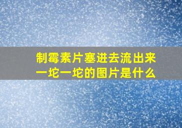 制霉素片塞进去流出来一坨一坨的图片是什么