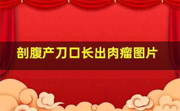 剖腹产刀口长出肉瘤图片