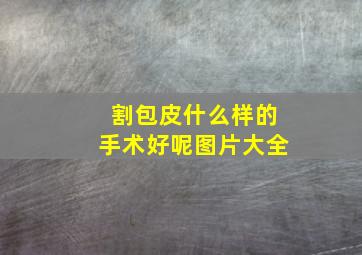 割包皮什么样的手术好呢图片大全