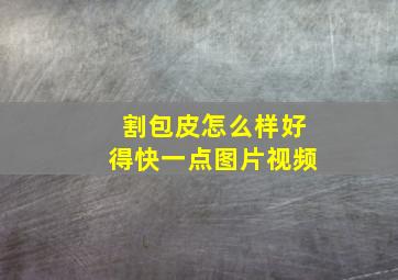 割包皮怎么样好得快一点图片视频