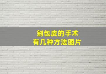 割包皮的手术有几种方法图片