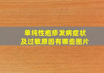 单纯性疱疹发病症状及过敏原因有哪些图片