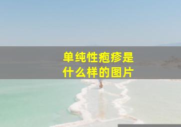 单纯性疱疹是什么样的图片