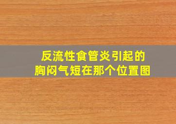 反流性食管炎引起的胸闷气短在那个位置图