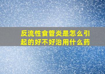 反流性食管炎是怎么引起的好不好治用什么药