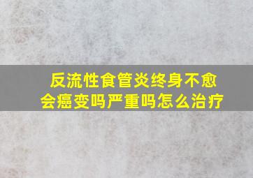 反流性食管炎终身不愈会癌变吗严重吗怎么治疗