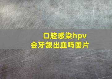 口腔感染hpv会牙龈出血吗图片