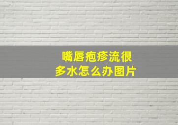 嘴唇疱疹流很多水怎么办图片