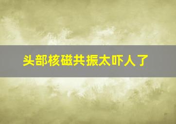 头部核磁共振太吓人了