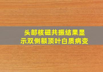 头部核磁共振结果显示双侧额顶叶白质病变