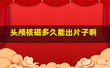 头颅核磁多久能出片子啊