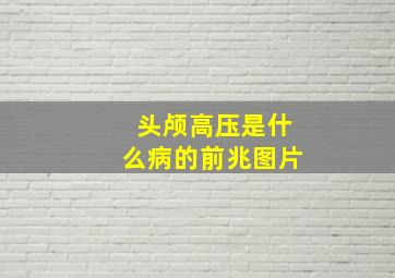 头颅高压是什么病的前兆图片