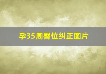 孕35周臀位纠正图片