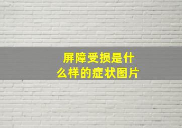 屏障受损是什么样的症状图片