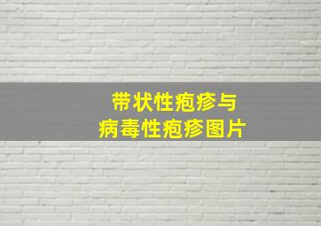 带状性疱疹与病毒性疱疹图片