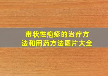 带状性疱疹的治疗方法和用药方法图片大全