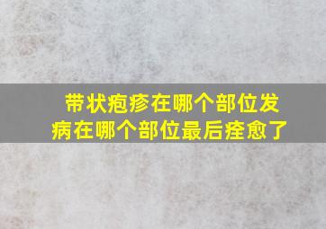 带状疱疹在哪个部位发病在哪个部位最后痊愈了