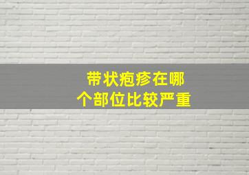 带状疱疹在哪个部位比较严重