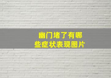 幽门堵了有哪些症状表现图片