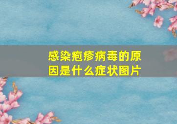 感染疱疹病毒的原因是什么症状图片