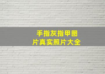 手指灰指甲图片真实照片大全