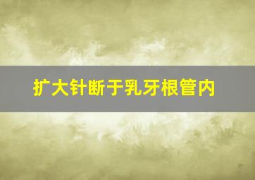 扩大针断于乳牙根管内