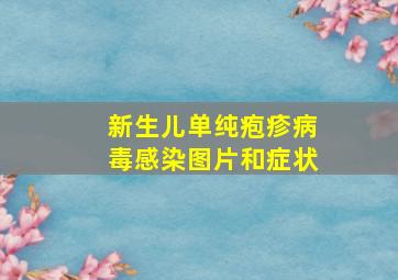 新生儿单纯疱疹病毒感染图片和症状