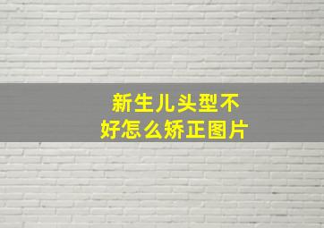 新生儿头型不好怎么矫正图片