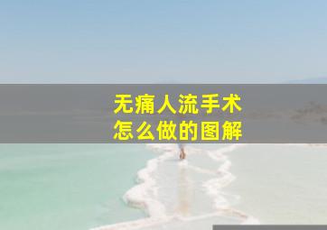 无痛人流手术怎么做的图解