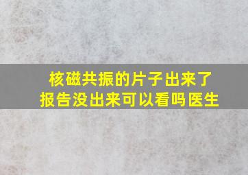 核磁共振的片子出来了报告没出来可以看吗医生