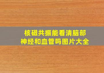 核磁共振能看清脑部神经和血管吗图片大全