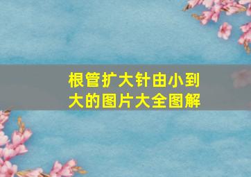 根管扩大针由小到大的图片大全图解