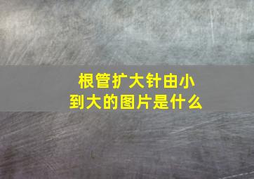 根管扩大针由小到大的图片是什么