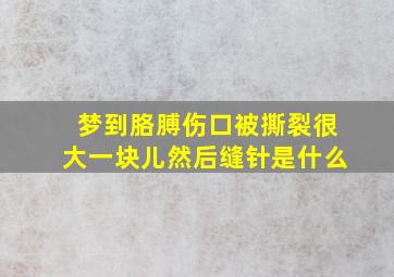 梦到胳膊伤口被撕裂很大一块儿然后缝针是什么