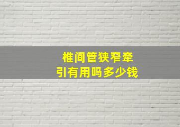 椎间管狭窄牵引有用吗多少钱