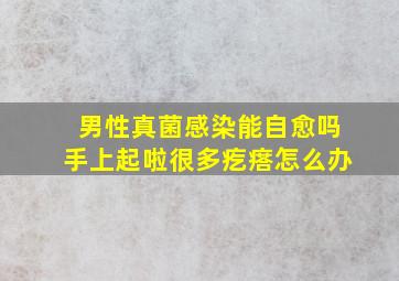 男性真菌感染能自愈吗手上起啦很多疙瘩怎么办