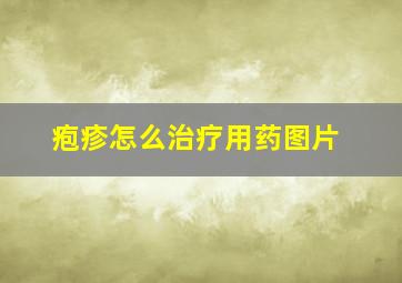 疱疹怎么治疗用药图片