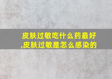 皮肤过敏吃什么药最好,皮肤过敏是怎么感染的