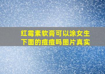 红霉素软膏可以涂女生下面的痘痘吗图片真实