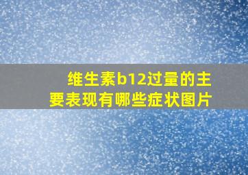 维生素b12过量的主要表现有哪些症状图片