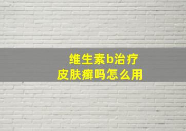 维生素b治疗皮肤癣吗怎么用